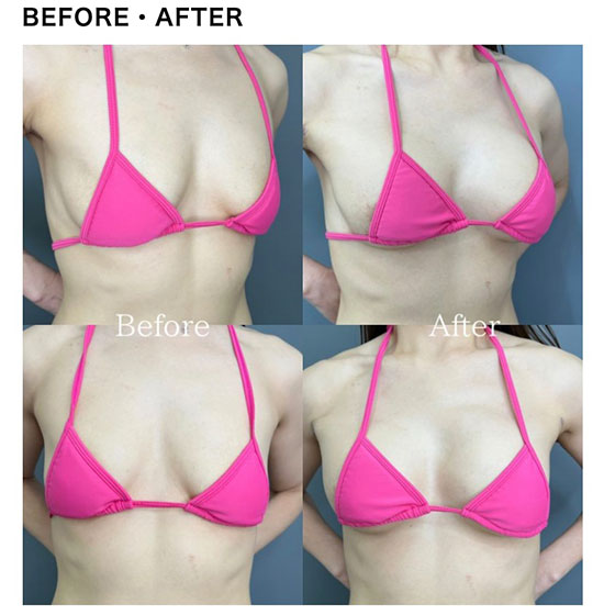 TCB東京中央美容外科