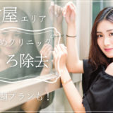 ほくろ除去 名古屋 おすすめ