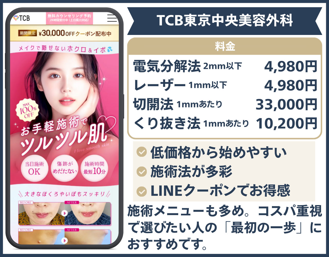 TCB東京中央美容外科