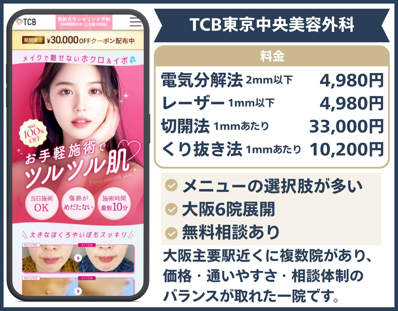 TCB東京中央美容外科