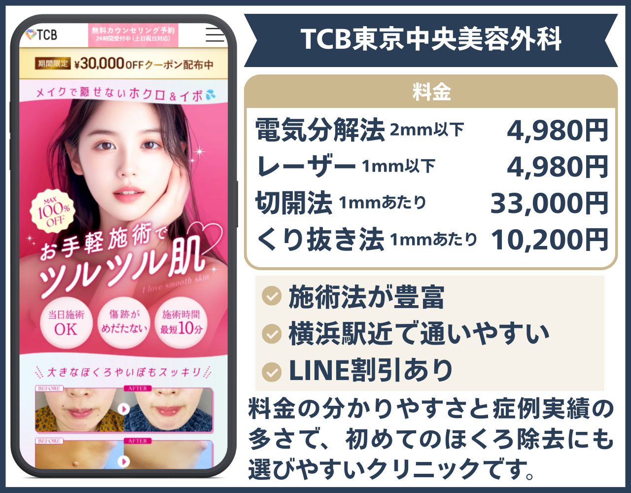 TCB東京中央美容外科 横浜院