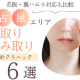 クマ取り 名古屋 おすすめ